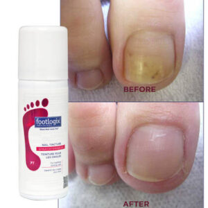 ANTI-FUNGAL TOE TINCTURE SPRAY - Image 2